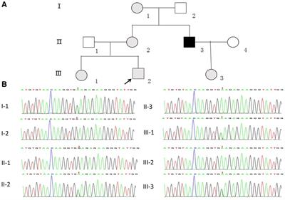 A deep intronic splice variant of the COL4A5 gene in a Chinese family with X-linked Alport syndrome